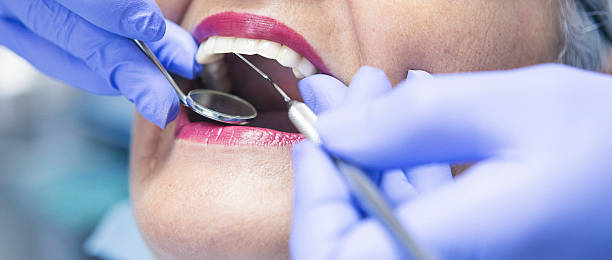 Best Urgent Care for Lost Fillings or Crowns in Madison, WI